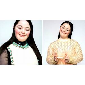 Ellie Goldstein, jeune femme trisomique devenue mannequin pour la marque Gucci